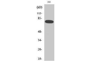 Western Blotting (WB) image for anti-Nuclear Factor-kB p65 (NFkBP65) (pSer468) antibody (ABIN3182087) (NF-kB p65 anticorps  (pSer468))