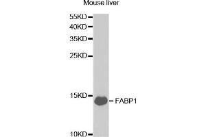 Western Blotting (WB) image for anti-Fatty Acid Binding Protein 1, Liver (FABP1) antibody (ABIN1876499) (FABP1 anticorps)
