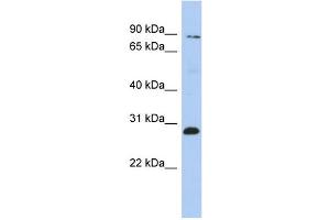 WB Suggested Anti-ZNF148 Antibody Titration:  0. (ZNF148 anticorps  (Middle Region))