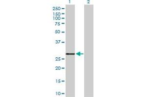 Western Blot analysis of PRSS2 expression in transfected 293T cell line by PRSS2 MaxPab polyclonal antibody. (PRSS2 anticorps  (AA 1-247))