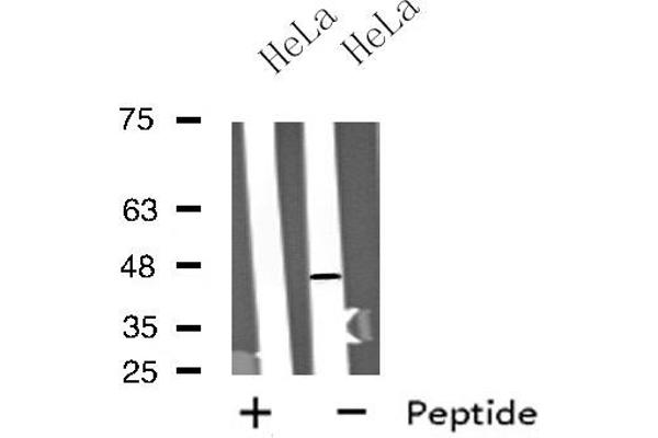 Motilin Receptor anticorps  (C-Term)