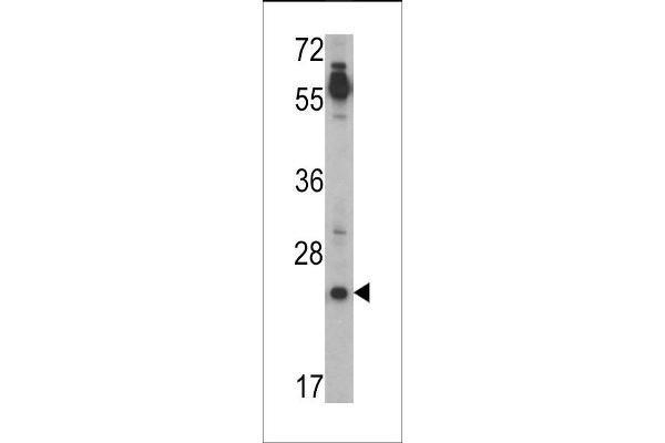 TDGF1 anticorps  (N-Term)