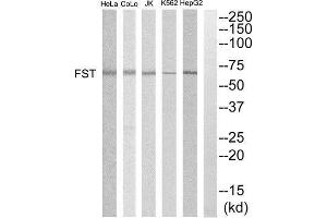 Western Blotting (WB) image for anti-Follistatin (FST) (Internal Region) antibody (ABIN1852806) (Follistatin anticorps  (Internal Region))