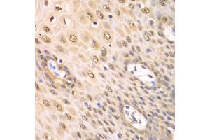 Immunohistochemistry of paraffin-embedded human esophagus using PSMA2 antibody. (PSMA2 anticorps)