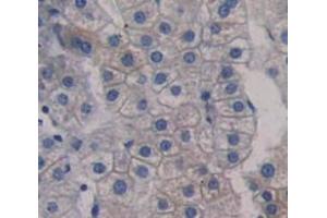 Used in DAB staining on fromalin fixed paraffin- embedded Kidney tissue (SLC22A4 anticorps  (AA 42-141))