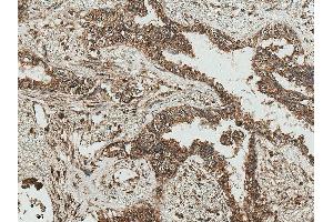 Immunohistochemistry analysis using Rabbit Anti-RICTOR Polyclonal Antibody (ABIN5696202). (RICTOR anticorps  (AA 1060-1160) (Biotin))