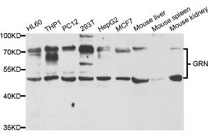 Western blot analysis of extracts of various cell lines, using GRN antibody (ABIN5973395) at 1/1000 dilution. (Granulin anticorps)