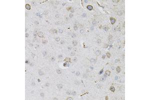 Immunohistochemistry of paraffin-embedded mouse brain using CEACAM5 antibody (ABIN6291892) (40x lens). (CEACAM5 anticorps)