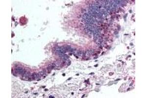 Immunohistochemistry (IHC) image for anti-Histone Deacetylase 4 (HDAC4) (AA 194-209) antibody (ABIN2470109) (HDAC4 anticorps  (AA 194-209))