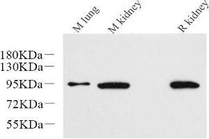 Western Blot analysis of various samples using Catenin beta Monoclonal Antibody at dilution of 1:1000. (beta Catenin anticorps)