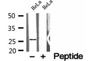 Western blot analysis of extracts of HeLa cells, using NUDT21 antibody. (NUDT21 anticorps  (Internal Region))