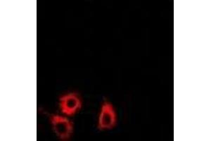 Immunofluorescence (IF) image for anti-SET and MYND Domain Containing 4 (SMYD4) (AA 1-260) antibody (ABIN5936313) (SMYD4 anticorps  (AA 1-260))