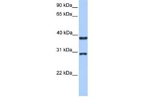 KLHDC1 anticorps  (N-Term)