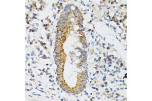 Immunohistochemistry of paraffin-embedded human vermiform appendix using SRP19 antibody (ABIN5974084) at dilution of 1/100 (40x lens). (SRP19 anticorps)