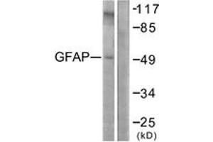Western blot analysis of extracts from COLO205 cells, using GFAP (Ab-38) Antibody. (GFAP anticorps  (AA 11-60))