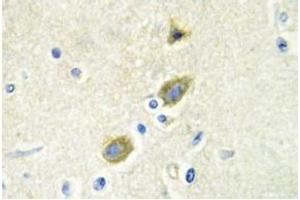 Image no. 2 for anti-Growth Arrest-Specific 6 (GAS6) antibody (ABIN317613) (GAS6 anticorps)