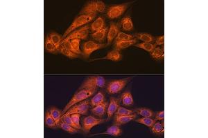 Immunofluorescence analysis of U-2 OS cells using CLOCK Rabbit mAb (ABIN7266414) at dilution of 1:100 (40x lens). (CLOCK anticorps)