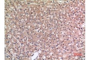 Immunohistochemical analysis of paraffin-embedded human-liver, antibody was diluted at 1:100. (SLC10A1 anticorps  (C-Term))