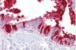 Immunohistochemistry with Lung, respiratory epithelium tissue at an antibody concentration of 5µg/ml using anti-SCGB1A1 antibody (ARP41524_P050) (SCGB1A1 anticorps  (Middle Region))