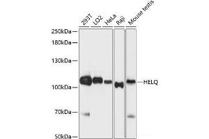 Western blot analysis of extracts of various cell lines using HEL308 Polyclonal Antibody at dilution of 1:3000. (HEL308 anticorps)
