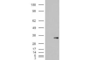 Western Blotting (WB) image for anti-WNT1 Inducible Signaling Pathway Protein 1 (WISP1) (C-Term) antibody (ABIN2466452) (WISP1 anticorps  (C-Term))