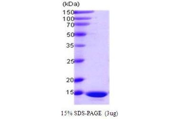 PDCD5 Protein (AA 1-125)