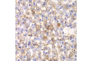 Immunohistochemistry of paraffin-embedded rat liver using H antibody (ABIN6129787, ABIN6141601, ABIN6141603 and ABIN6216048) at dilution of 1:100 (40x lens). (HAPLN1 anticorps  (AA 165-354))