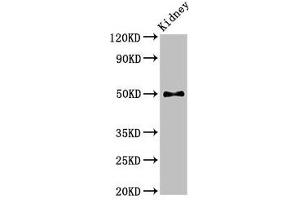 Western Blot Positive WB detected in: Mouse kidney tissue All lanes: PDK1 antibody at 2. (PDPK1 anticorps  (AA 294-432))