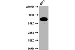 Western Blot Positive WB detected in: K562 whole cell lysate All lanes: PARP antibody at 1:2000 Secondary Goat polyclonal to rabbit IgG at 1/50000 dilution Predicted band size: 114 KDa Observed band size: 114 kDa (Recombinant PARP1 anticorps)