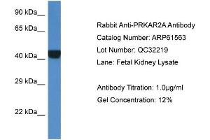 Western Blotting (WB) image for anti-Protein Kinase, CAMP-Dependent, Regulatory, Type II, alpha (PRKAR2A) (Middle Region) antibody (ABIN786444) (PRKAR2A anticorps  (Middle Region))