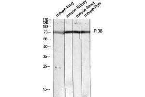 Western Blot (WB) analysis of Mouse Lung Mouse Kidney Mouse Heart Mouse Liver lysis using F13B antibody. (F13B anticorps)