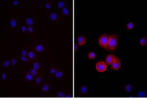 Human pancreatic carcinoma cell line MIA PaCa-2 was stained with Mouse Anti-Human CD44-UNLB, and DAPI. (Âne anti-Souris IgG (Heavy & Light Chain) Anticorps (HRP) - Preadsorbed)