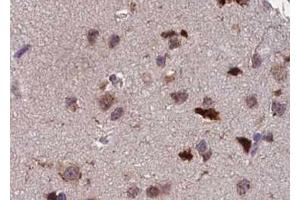 ABIN6267391 at 1/100 staining human brain tissue sections by IHC-P. (ATF2 anticorps  (pThr55, pThr73))