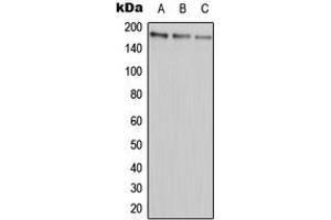 Western blot analysis of ABCA9 expression in HEK293T (A), Raw264. (ABCA9 anticorps  (Center))