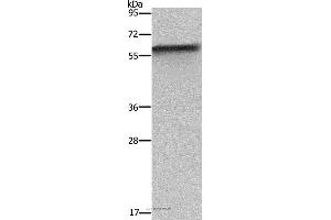 Western blot analysis of Mouse liver tissue, using FKBP8 Polyclonal Antibody at dilution of 1:1150 (FKBP8 anticorps)