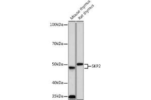 Western blot analysis of extracts of various cell lines, using SKP2 Rabbit mAb (ABIN1680764, ABIN3018459, ABIN3018460 and ABIN7101615) at 1:1000 dilution. (SKP2 anticorps)