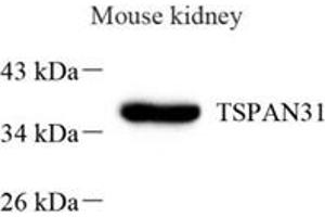 Western blot analysis of TSPAN31 (ABIN7075868) at dilution of 1: 1000,Lane 1: Mouse kidney tissue lysate (TSPAN31 anticorps)