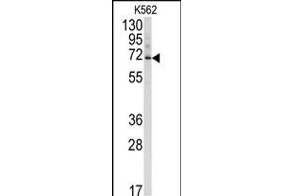 Ubiquilin 3 anticorps  (N-Term)