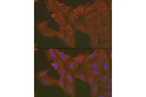 Immunofluorescence analysis of U2OS cells using [KO Validated] Caspase-3 Rabbit pAb (ABIN6131582, ABIN6137962, ABIN6137964 and ABIN6215049) at dilution of 1:100 (40x lens). (Caspase 3 anticorps  (AA 55-160))