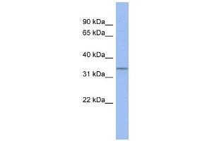 C17ORF78 antibody used at 1 ug/ml to detect target protein. (C17orf78 anticorps  (Middle Region))