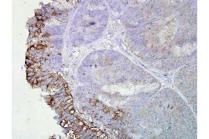 Immunohistochemistry analysis using Mouse Anti-Hsp90 Monoclonal Antibody, Clone AC-16 . (HSP90 anticorps  (APC))