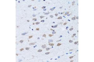 Immunohistochemistry of paraffin-embedded rat brain using LDLRAP1 antibody. (LDLRAP1 anticorps)