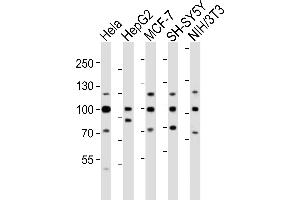 Western blot analysis of lysates from Hela, HepG2, MCF-7, SH-SY5Y, mouse NIH/3T3 cell line (from left to right), using FGFR1 Antibody (Center) (ABIN6243223 and ABIN6577702). (FGFR1 anticorps  (AA 291-324))