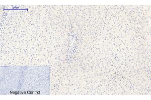 Immunohistochemical analysis of paraffin-embedded human liver tissue. (NFKBIA anticorps  (pSer32))