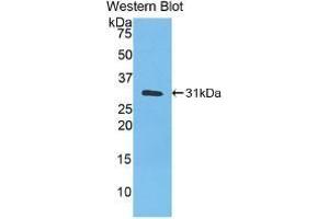 Detection of Recombinant CA3, Human using Monoclonal Antibody to Carbonic Anhydrase III, Muscle Specific (CA3) (CA3 anticorps  (AA 2-260))