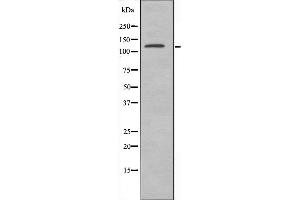Western blot analysis of extracts from HeLa cells using BUB1B antibody. (BUB1B anticorps  (C-Term))