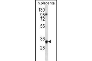 Western blot analysis in human placenta tissue lysates (35ug/lane). (OR6N2 anticorps  (C-Term))