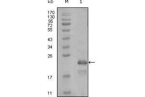 Western Blot showing HAND1 antibody used against truncated Trx-HAND1 recombinant protein (1). (HAND1 anticorps  (AA 90-190))