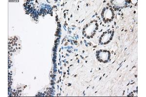 Immunohistochemical staining of paraffin-embedded Ovary tissue using anti-FCGR2A mouse monoclonal antibody. (FCGR2A anticorps)