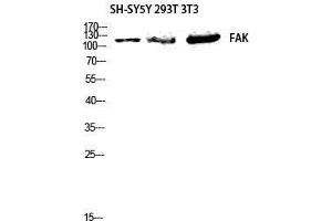 Western Blot (WB) analysis of SH-SYSY 293 3T3 lysis using FAK antibody. (FAK anticorps  (Thr444))